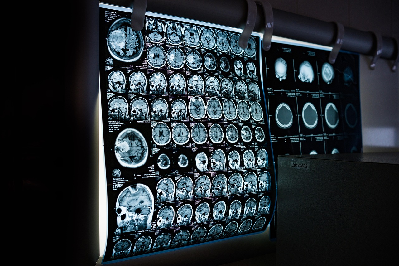 journey-01 x-ray, mri, ct scan, computed tomography, magnetic resonance imaging, medicine, neurology, healthcare, x-ray, mri, mri, mri, mri, mri, ct scan, medicine, neurology, neurology, healthcare, healthcare